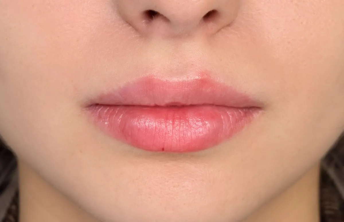 Swedish Lips: after