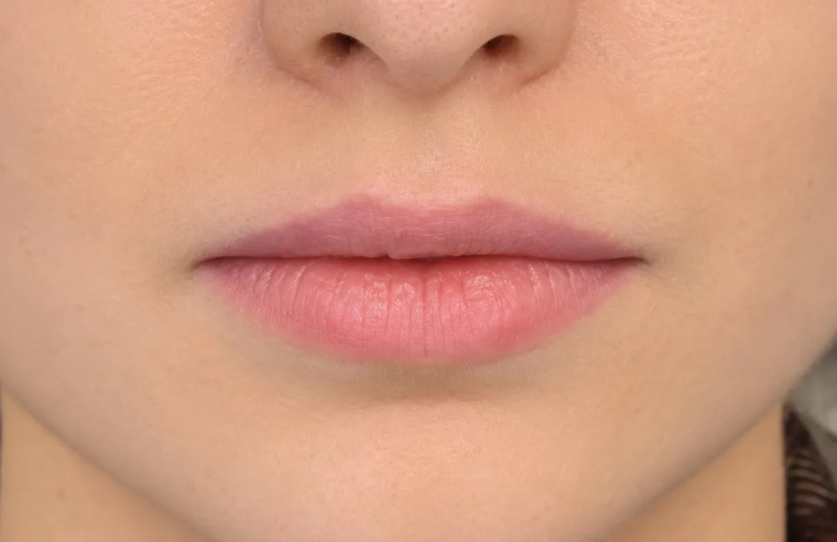 Swedish Lips: before
