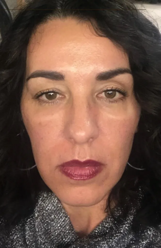 Patient result: after