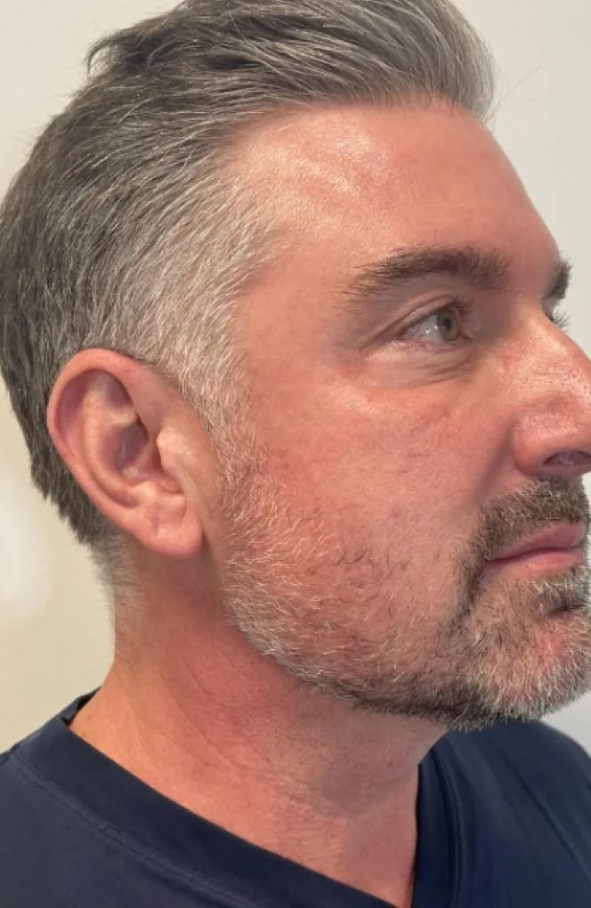 Patient result: after