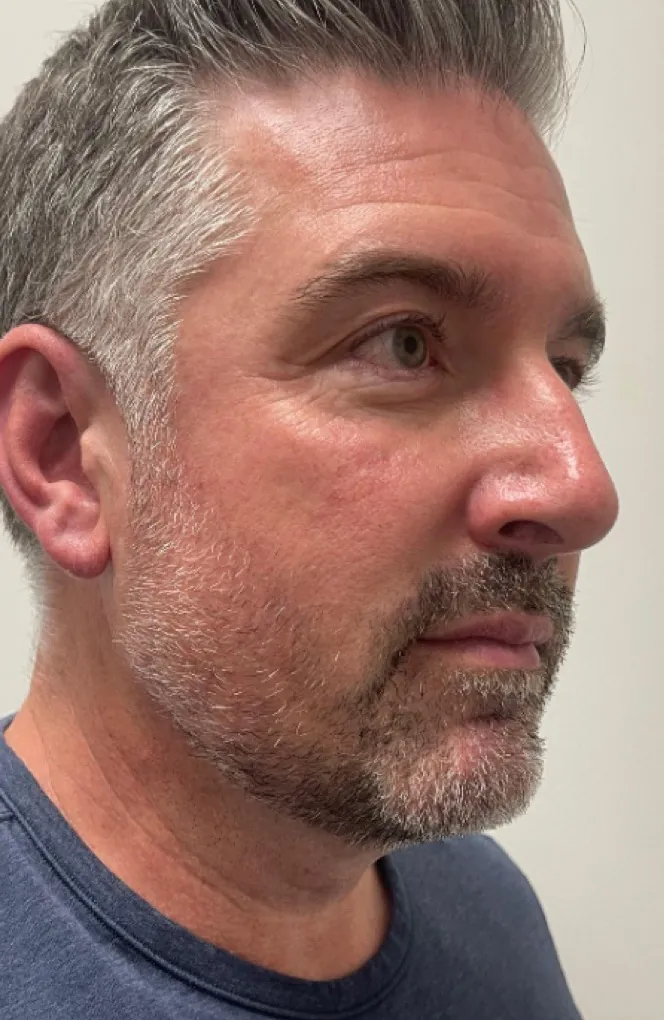 Patient result: before