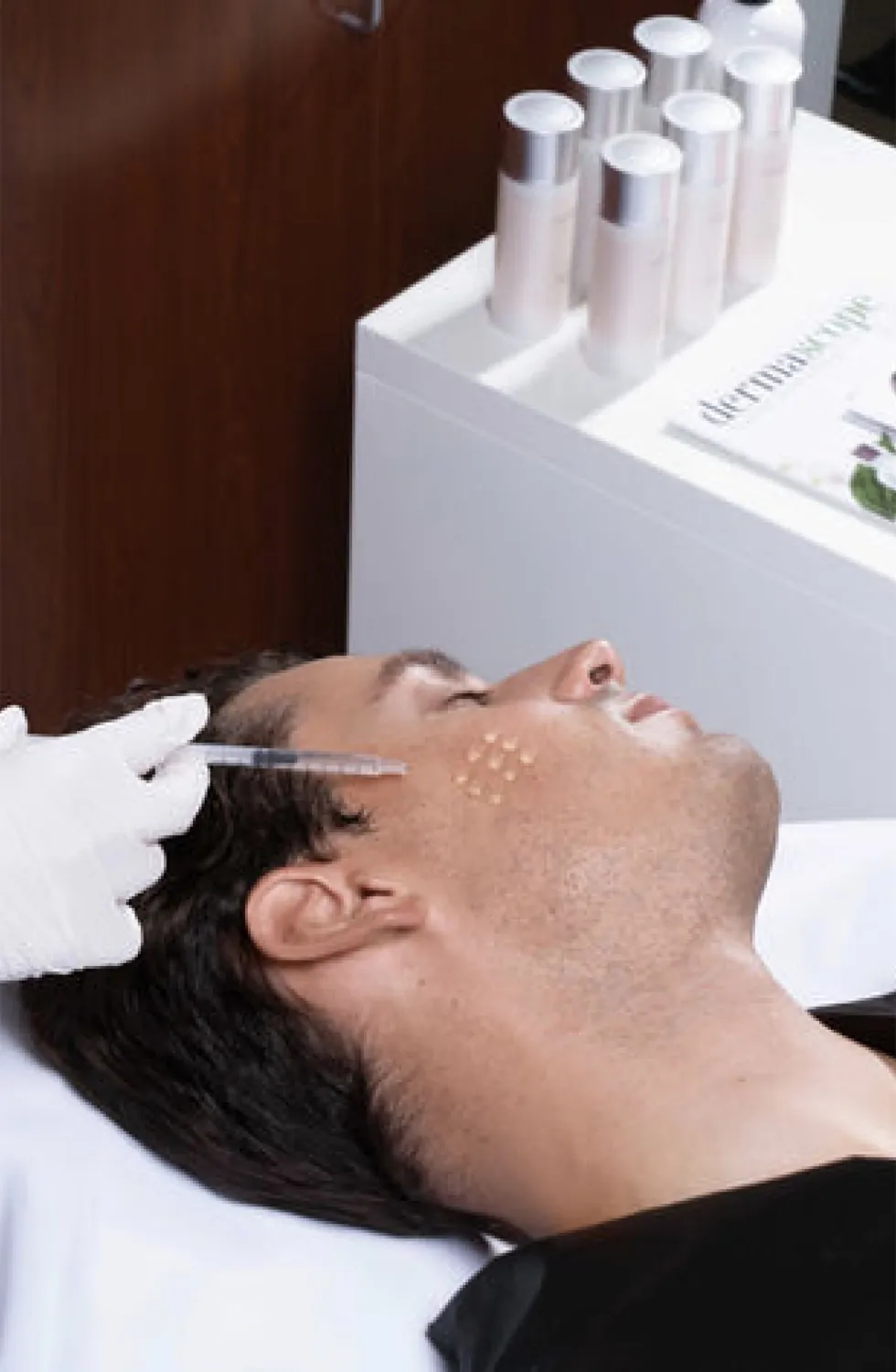 A man receiving a microneedling treatment on his face